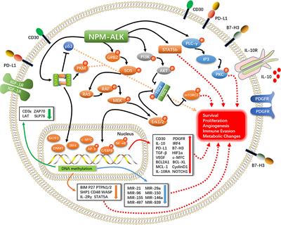 Holistic View of ALK TKI Resistance in ALK-Positive Anaplastic Large Cell Lymphoma